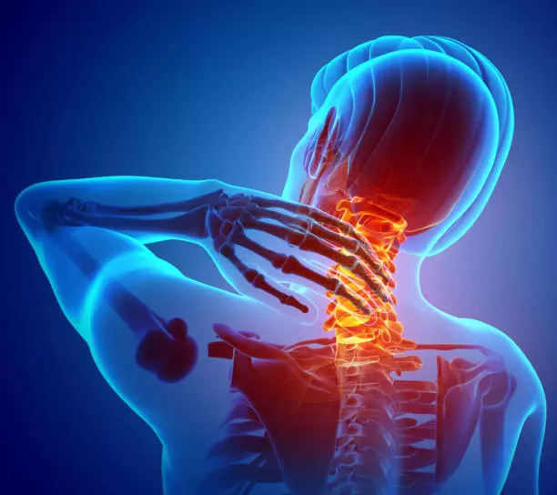 How To Value Your Head And Neck Pain After Car Accident